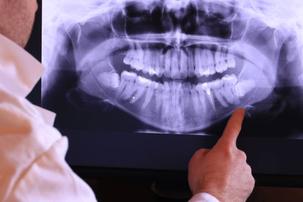 Best Emergency Root Canal Treatment in Hamilton, MT