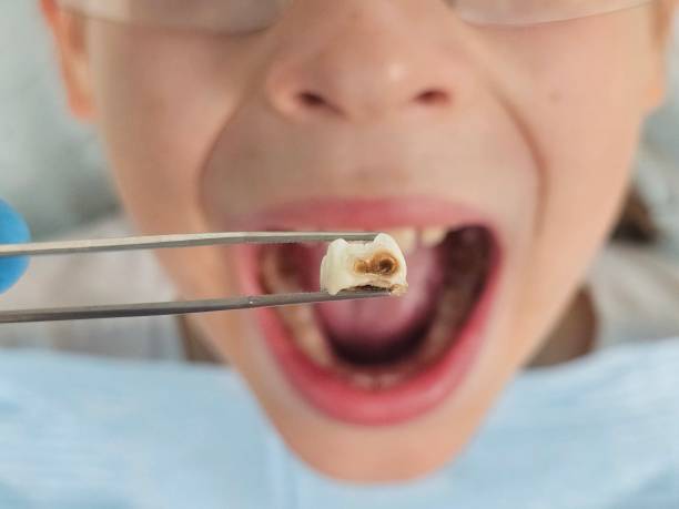 Best Pediatric Emergency Dentist in Hamilton, MT