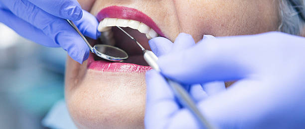 Best Emergency Gum Treatment in Hamilton, MT